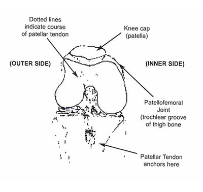 diagram of knee showing the patellar tendon, knee cap, patellofemoral joint, and where the patellar tendon anchors
