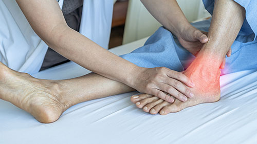 tarsal tunnel syndrome